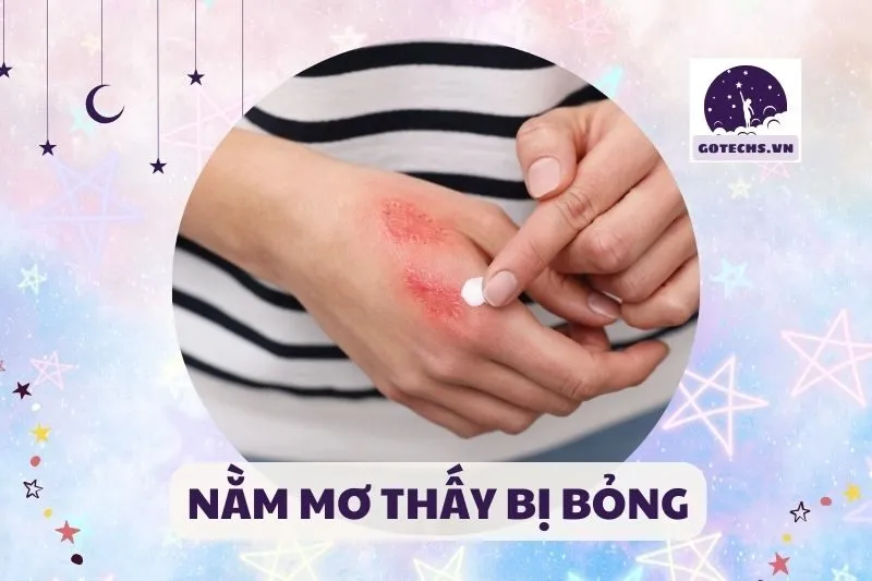 NẰM MƠ THẤY BỊ BỎNG