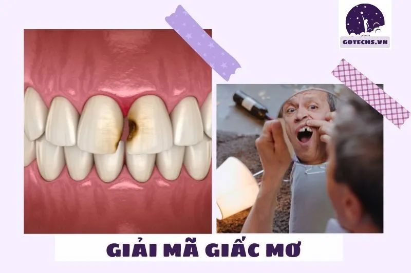 Nằm Mơ Thấy Rụng Răng Có Điềm Báo Gì? Tốt Hay Xấu?