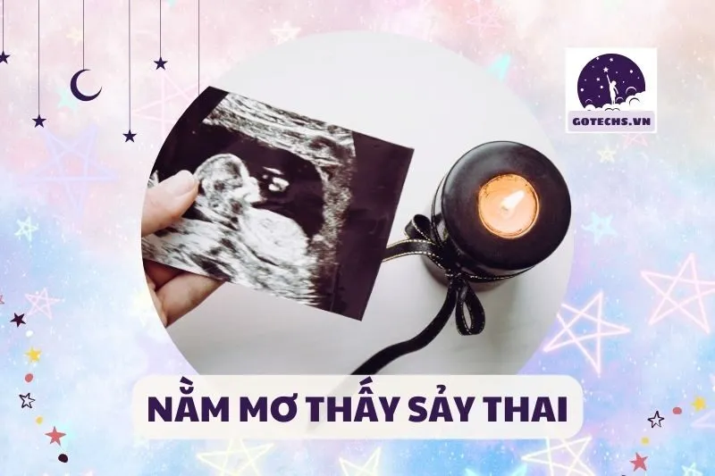 NẰM MƠ THẤY SẢY THAI