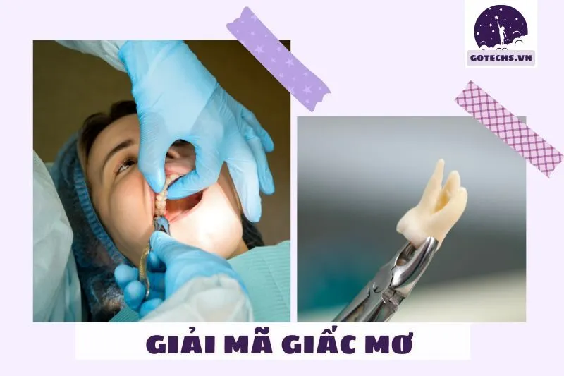 Ý Nghĩa Tâm Linh Khi Mơ Thấy Nhổ Răng