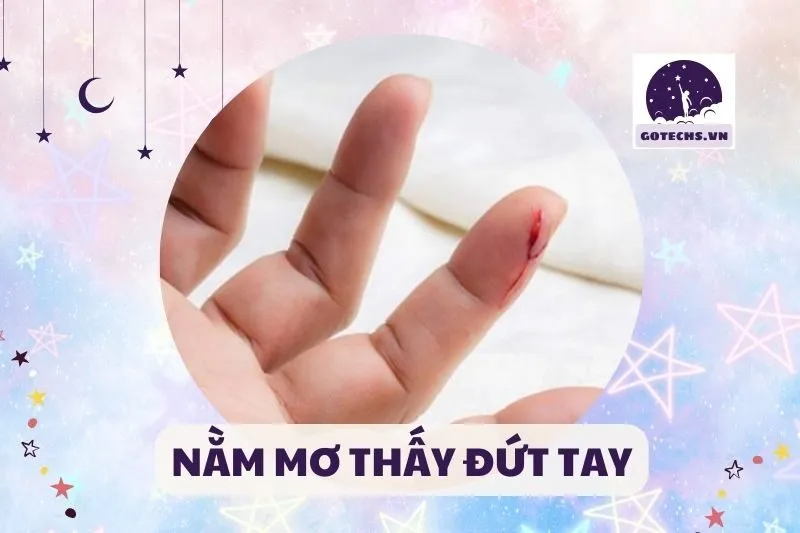NẰM MƠ THẤY ĐỨT TAY